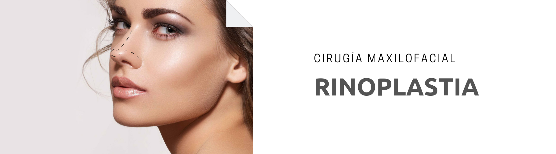 Rinoplastia. Dr Antio Vazquez cirujano maxilofacial en Barcelona España