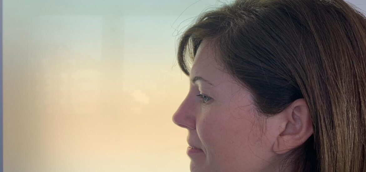 Después de una rinoplastia ultrasónica en AVR Maxilofacial Barcelona