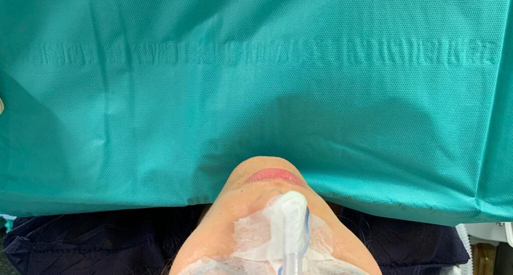 Feminización facial del mentón