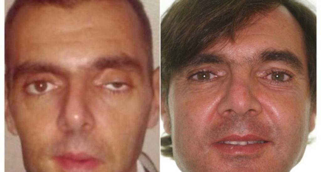 Reconstrucción orbitaria postraumática