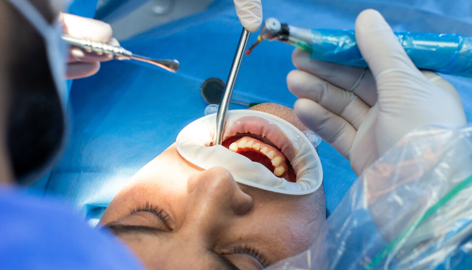 Cirugía Maxilofacial  Dr. Antonio Vázquez, cirujano maxilofacial en Barcelona