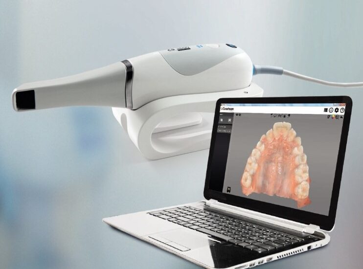 Scanner intraoral Dr. Antonio Vázquez, cirujano maxilofacial en Barcelona