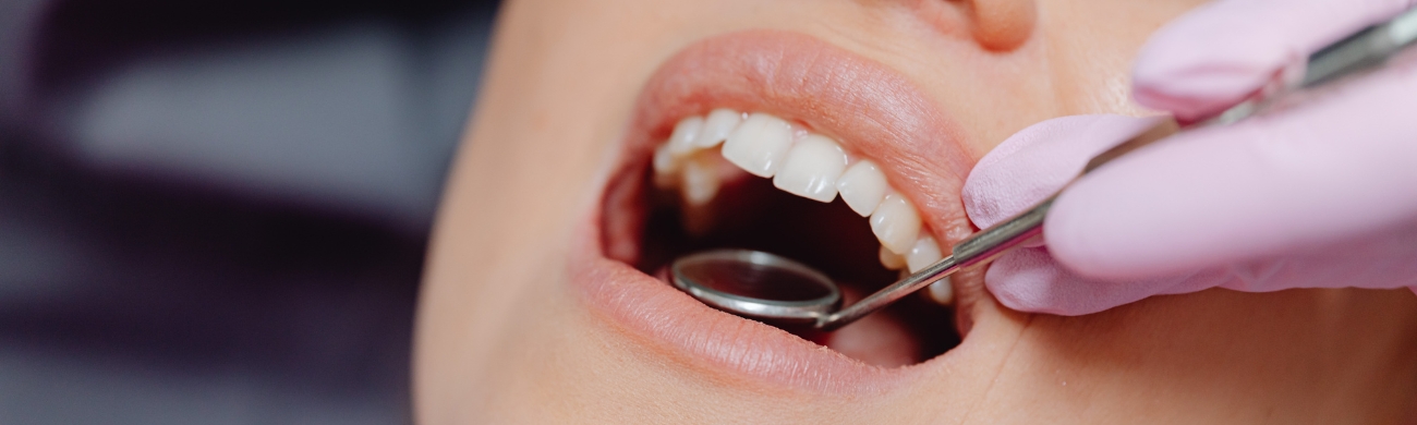 Quistes en la boca Tratamiento de quistes maxilares en AVR Clínica de Cirugía Maxilofacial