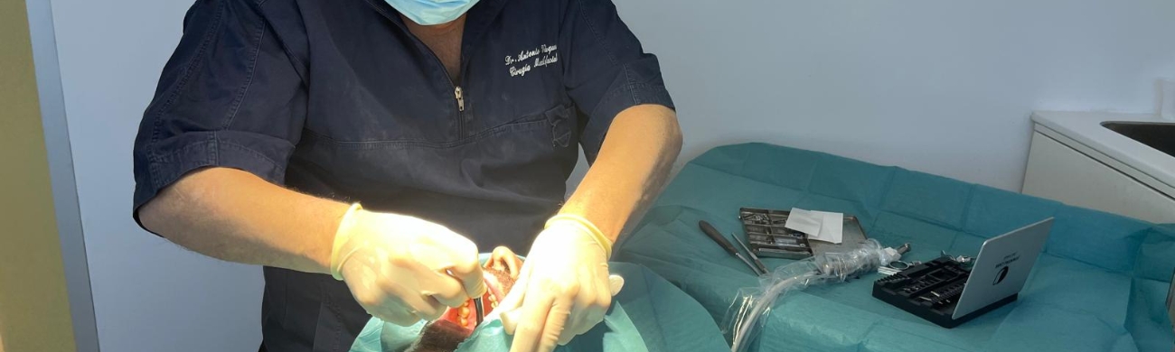 Extracción de cordales Extracción de cordales en AVR Clínica de Cirugía Maxilofacial