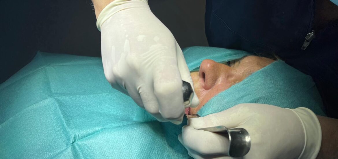 Reemplazo en implante dental para paciente de 68 años