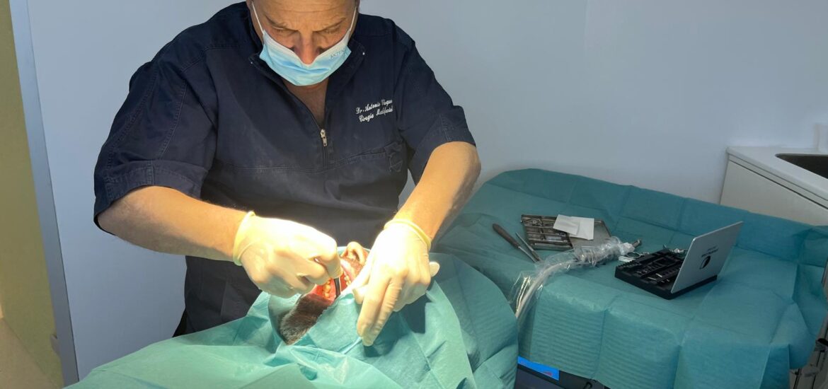 Caso de colocación de implantes mínimamente invasiva Innovación y eficiencia en la Cirugía Maxilofacial con el Dr. Antonio Vázquez