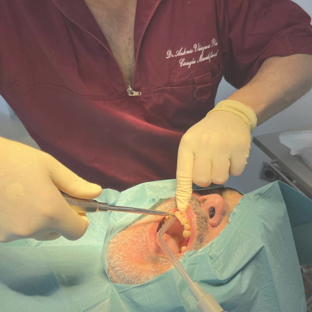 Transformación dental en una sola tarde a un paciente de 80 años