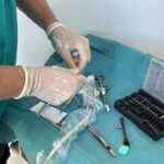 Innovación en implantes cigomáticos