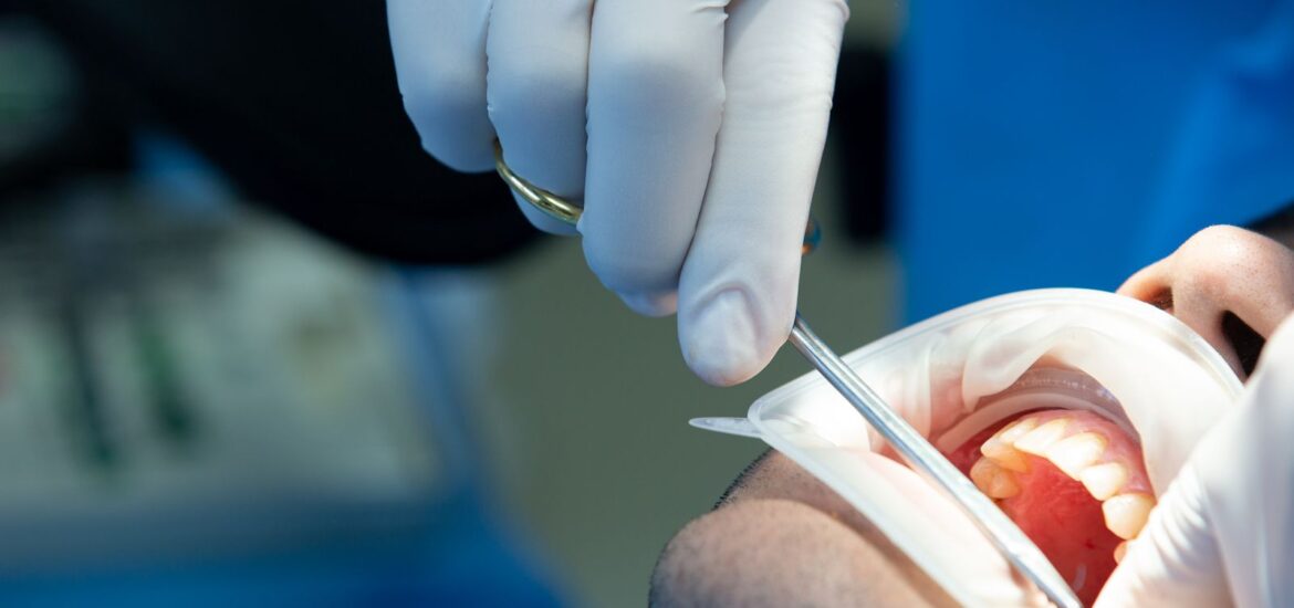Descubriendo los alcances de la cirugía oral Soluciones eficaces para problemas dentales y maxilofaciales