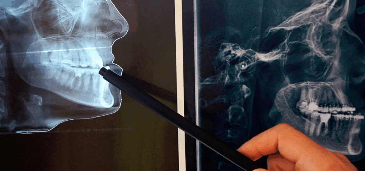 Reconstrucción y cuidado en traumatología facial Recuperando la funcionalidad y la estética tras un trauma