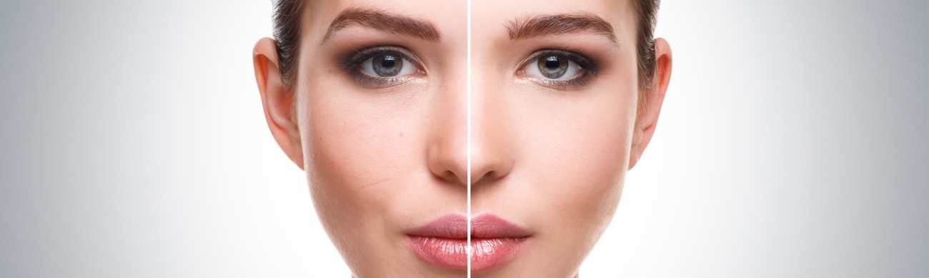 Asimetría facial Tratamiento de asimetría facial en AVR Clínica de Cirugía Maxilofacial
