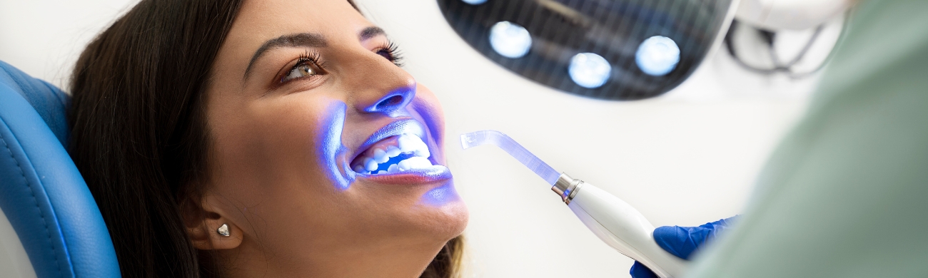 Blanqueamiento dental Tratamiento de blanqueamiento dental en AVR Clínica de Cirugía Maxilofacial