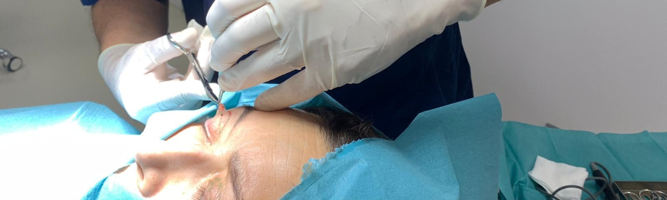 Blefaroplastia Tratamiento de blefaroplastia en AVR Clínica de Cirugía Maxilofacial
