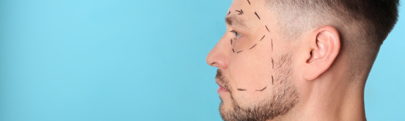 Masculinización facial Tratamiento de masculinización facial en AVR Clínica de Cirugía Maxilofacial