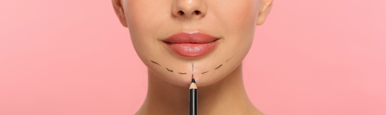 Mentoplastia Chin Wing Tratamiento de mentoplastia en AVR Clínica de Cirugía Maxilofacial