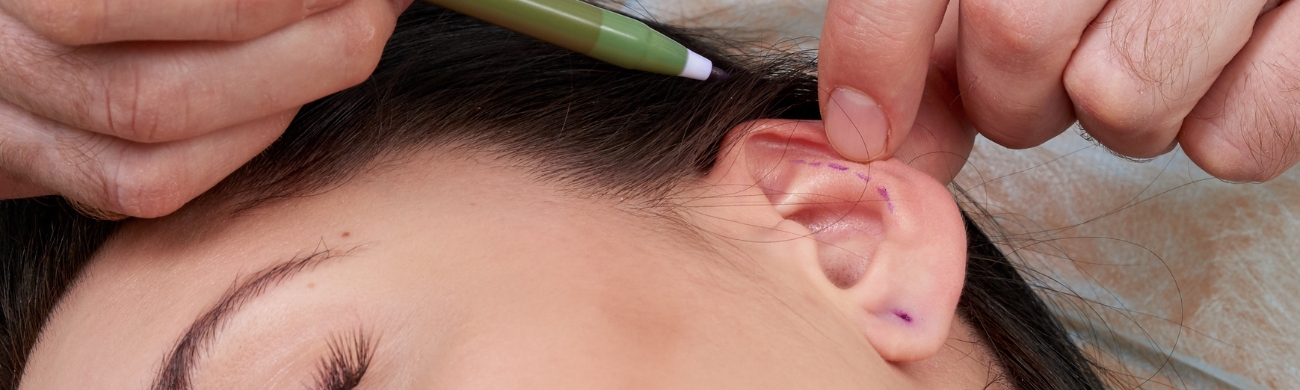 Otoplastia Tratamiento de otoplastia en AVR Clínica de Cirugía Maxilofacial