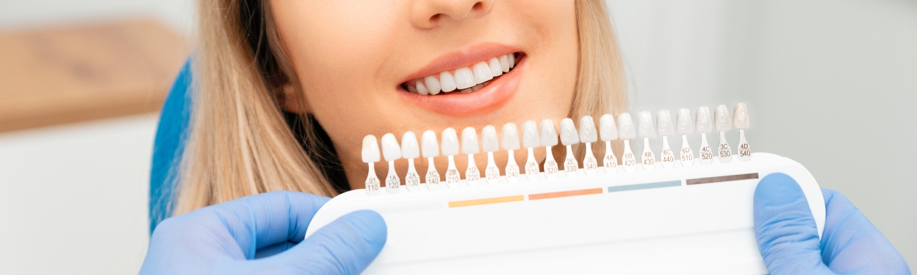 Carillas dentales Tratamiento de carillas dentales en AVR Clínica de Cirugía Maxilofacial