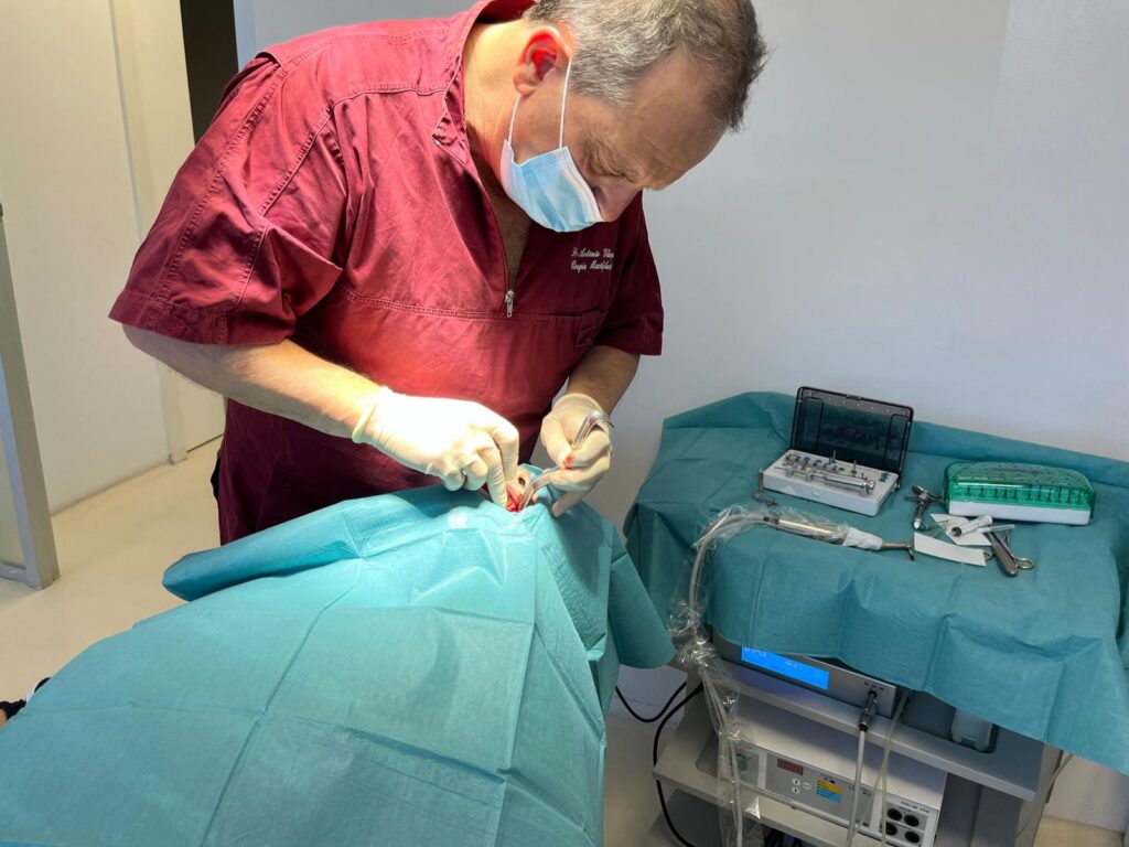 ¿Te han dicho que no puedes llevar implantes porque “no tienes hueso”? Esa frase quedó atrás. Hoy, la cirugía maxilofacial ofrece alternativas predecibles para colocar implantes incluso en pacientes con pérdida ósea severa