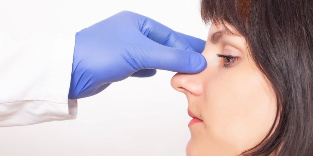 Lo que necesitas saber sobre el proceso de recuperación tras la rinoplastia ultrasónica