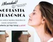 Rinoplastia ultrasónica