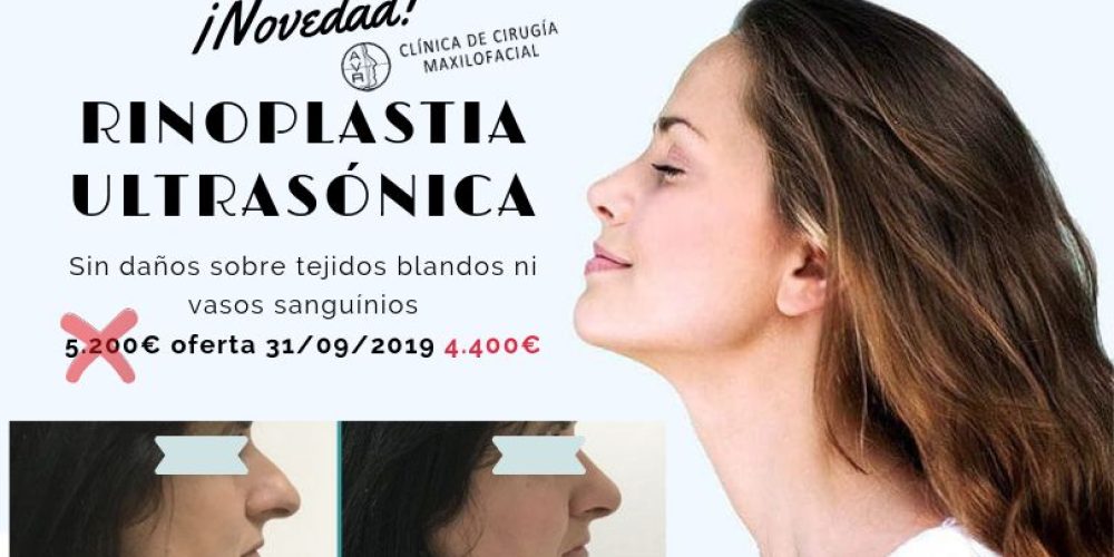 Rinoplastia ultrasónica