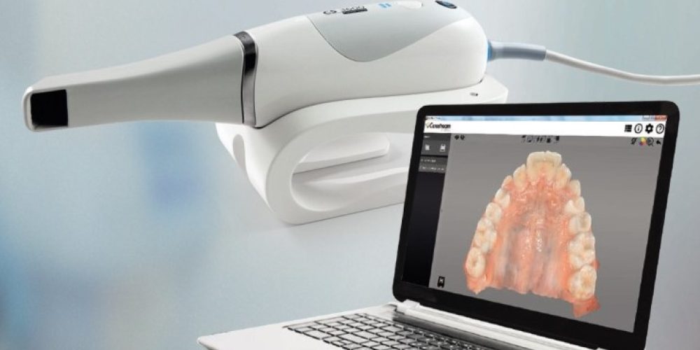 Scanner intraoral